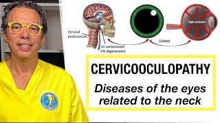 Cervicooculopathy: Diseases of the eyes related to the neck. Restore neck structure and vision!