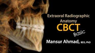 Basic CBCT (ConeBeam CT) Anatomy