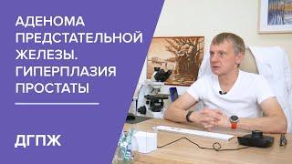 Аденома предстательной железы. Гиперплазия простаты (ДГПЖ). Что нужно знать пациенту?