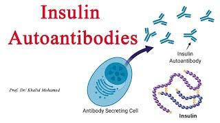 Insulin Autoantibodies