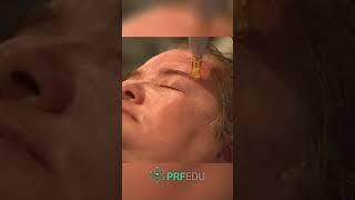 Dr. Ana Gossweiler for Advanced PRF in Facial Esthetics