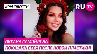 Оксана Самойлова показала себя после новой пластики!