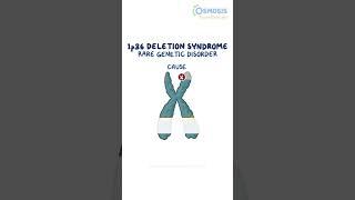 1p36 Deletion Syndrome