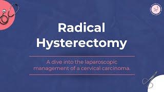 Radical Hysterectomy | Mayflower Women's Hospital