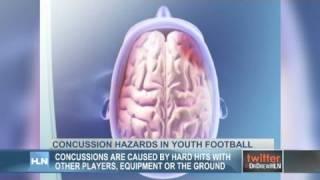 Concussion hazards in youth football