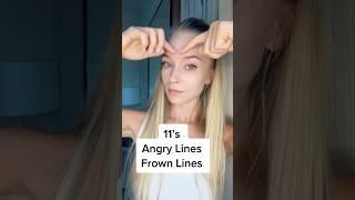 Reduce Angry Lines and 11s Lines - Here's HOW!