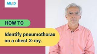 How to identify pneumothorax on a chest X-ray