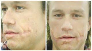 The Joker: 15 Crazy Things You Didn't Know About Heath Ledger’s Character