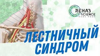 Лестничный синдром. Мягкая мануальная техника.