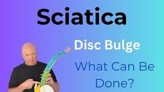 5 Exercises For Lumbar Disc Bulge With Sciatica