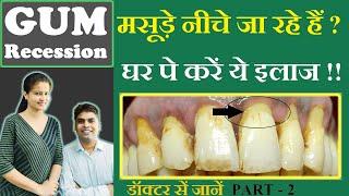 मसूड़े नीचे जा रहे हैं तो घर पे करें ये इलाज | gum recession treatment at home | masude niche jana