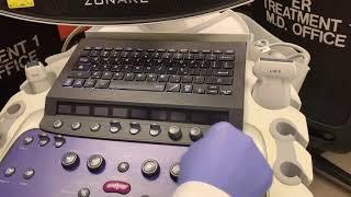 How to use Zonare Ultrasound machine