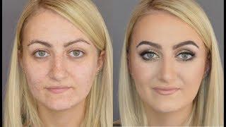 FLAWLESS MAKEUP | How I Cover Acne, Redness, Freckles and Scars