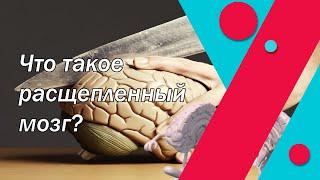 Что такое расщепленный мозг?