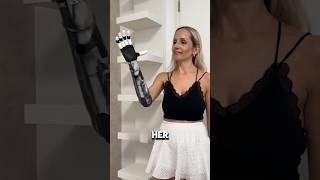 WOMEN WITH ROBOTIC HAND#shortsviral #robotichand #beautifulgirl