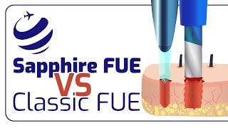 Sapphire FUE vs Classic FUE! What is The Basis Difference?