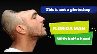 MEET HALFY, Miami  man with a half a head/carlos Rodriguez.