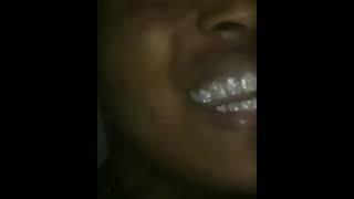 LOOK AT XXXTENTACION grillz look fresh ass hell