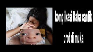 komplikasi kak vs adek crot di muka