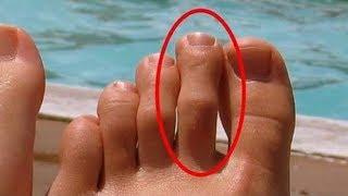 Do You Have This LONGER TOE? Then BEWARE with the GREEK FOOT - Activebeat