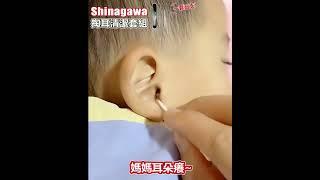 【五款不同掏耳勺，能有效清潔耳垢 】  掏耳清潔套組(5件套)2