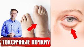 Болезни почек  7 признаков. Лучшие и худшие продукты для почек