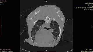 КТ компьютерная томография пневмонии у собаки