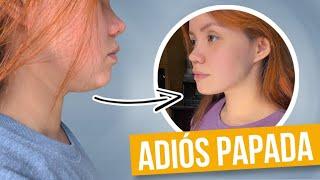 ADIÓS PAPADA (Auto-Masaje Reductor)