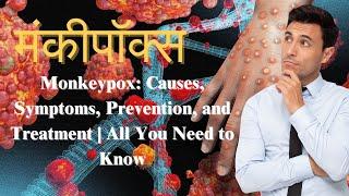 Monkeypox: Causes, Symptoms, Prevention, and Treatment | All You Need to Know #monkeypoxnews