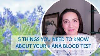 5 Things You Need To Know About Your Positive ANA