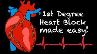 EMS Cardiology || Tachy Tuesday: 1st Degree Heart Block in EMS