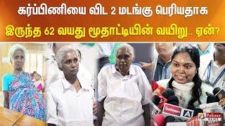 கர்ப்பிணியை விட 2 மடங்கு பெரியதாக இருந்த 62 வயது மூதாட்டியின் வயிறு.. ஏன்?...