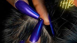 {ASMR} 1 HR Super Attentive NITPICKING SCALP WHITEHEADS | soft spoken | zoomed