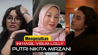 Mengejutkan Ini Hasil Visum Lolly Putri Nikita Mirzani