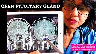  HEIGHT GROWTH? HOW TO OPEN PITUITARY GLAND NATURALLY? Increase HGH Release? Dr Rupal