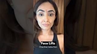 How to reduce fine eye lines with #faceyogabyvibhutiarora #eyecare #faceyoga #eyecream #beauty