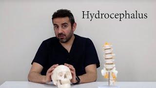 hydrocephalus | DR Kamran aghayev | brain surgery | spina bifida | neurosurgeon | neurosurgery |