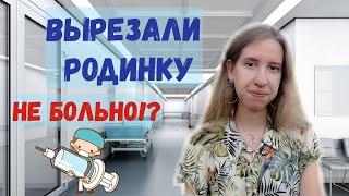 УДАЛЕНИЕ РОДИНКИ ХИРУРГИЧЕСКИМ ПУТЁМ// Стоит ли бояться подобной операции?// НЕ БОЛЬНО!? | Alex Li