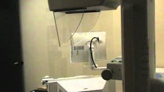 Digital Mammography Machine