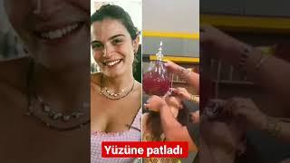 Aslı Bekiroğlu'nun yüzünde cam sebil patladı #aslıbekiroğlu #magazin #haber