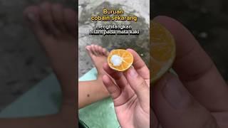 Menghilangkan hitam dimata kaki #lifeskills #tips #reallifehacks #tipspraktis #lifehacks