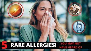 Top 5 Rare Allergies You May Not Have Heard Of - Most Strangest Allergies 2022