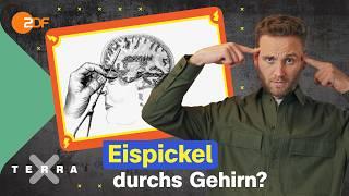 Brutale Lobotomie: Wie sind wir heute geschützt? | Brain Projects |Terra Xplore mit Leon Windscheid