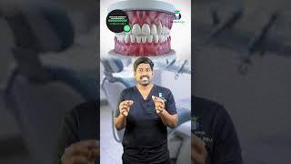 இறங்கிய பல் ஈறு! சரி செய்வது எப்படி? - Gingival Grafting for Recession |Dr. Karthikeyan |Denta Kings