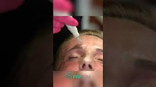 Dr. Alaina James for Advanced PRF in Facial Esthetics