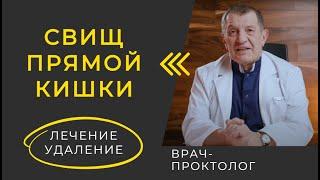 Сложный СВИЩ Прямой Кишки Операция. Удаление ректального СВИЩА. Лечение Анального СВИЩА