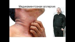 Что такое медикаментозная аллергия?