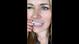 Retainer doesn't fit?  Here's what to do...  #shorts