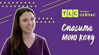 Современная дерматология | Спасите мою кожу | TLC