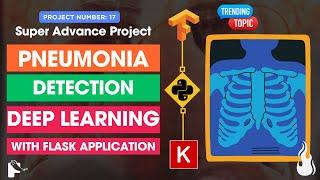 Advance DL Project : PNEUMONIA Detection Using Deep Learning | KNOWLEDGE DOCTOR | Mishu